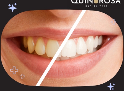 10 điều mà các nha sĩ KHÔNG BAO GIỜ làm với răng của họ bởi họ biết những điều này sẽ vô cùng ảnh hưởng đến sức khỏe răng miệng